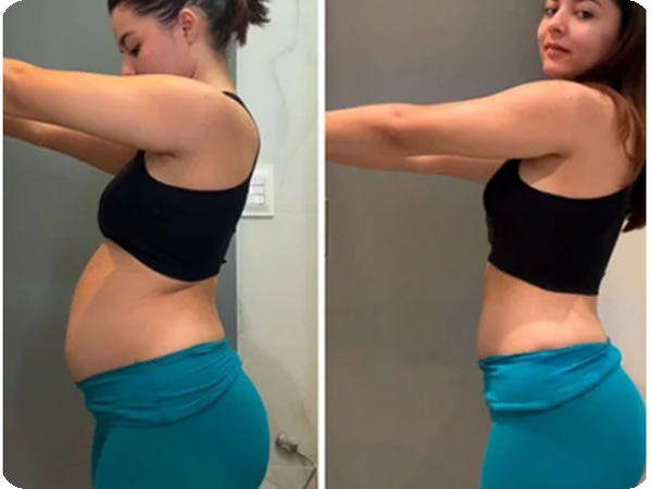 Transformação antes e depois 3