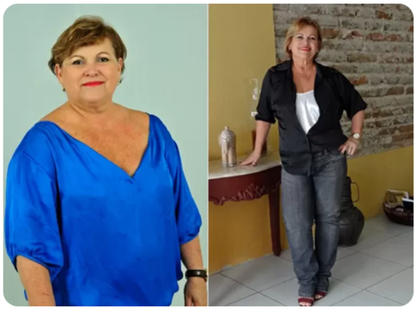 Transformação antes e depois 5
